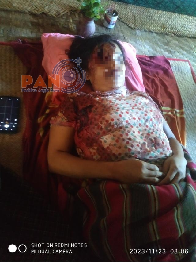 ဆင်ပေါင်ဝဲမြို့နယ်တွင်အမျိုးသမီး တစ်ဦး အကြမ်းဖက် PDF များ၏ သတ်ဖြတ်ခြင်းခံရ
